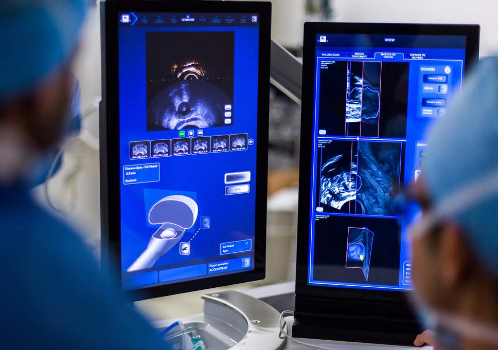 Are Prostate Cancer Deaths On The Rise?