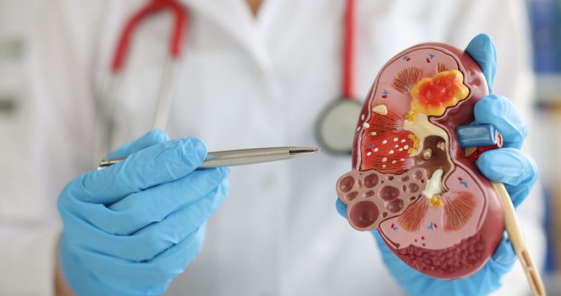 Where is Your Kidney? - Adult & Pediatric Urology