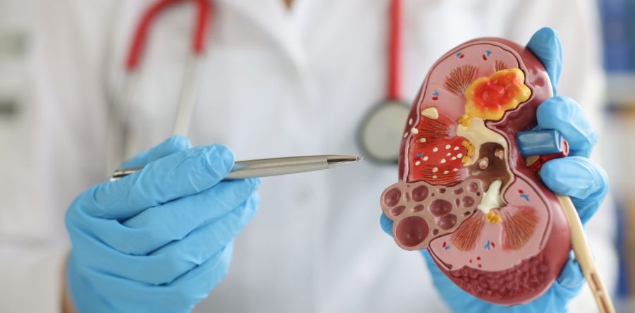 Where is Your Kidney?