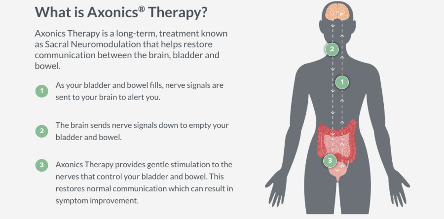 What is Axonics Therapy and Is It Right for You?
