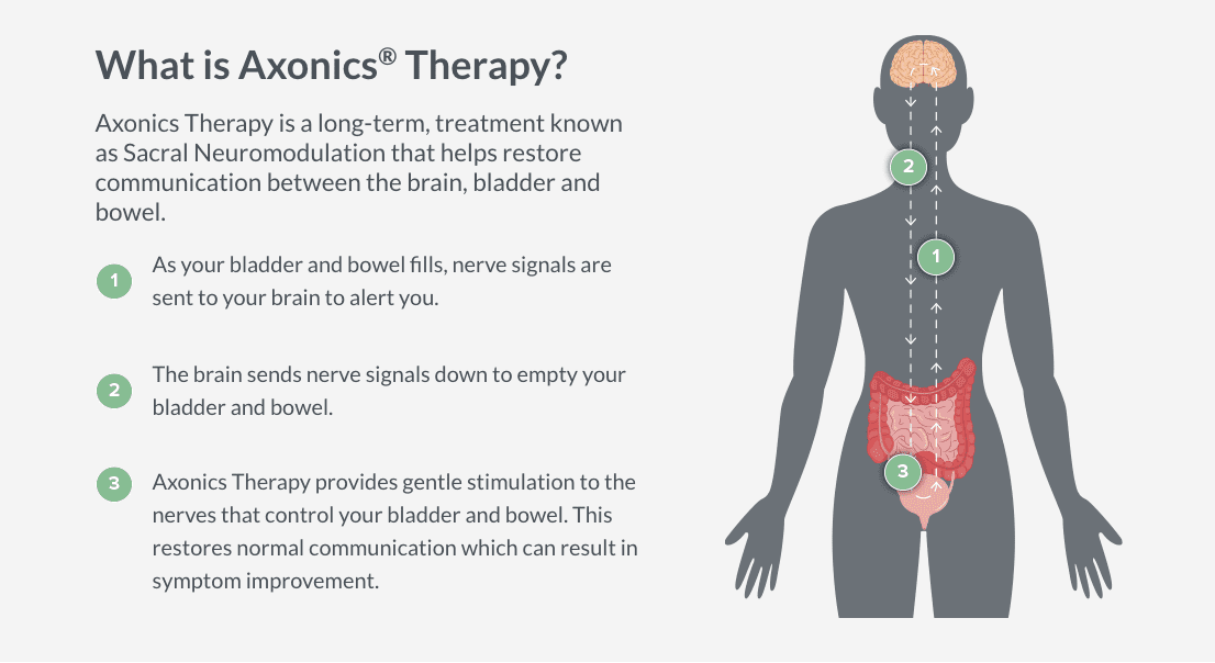 What is Axonics Therapy and Is It Right for You?
